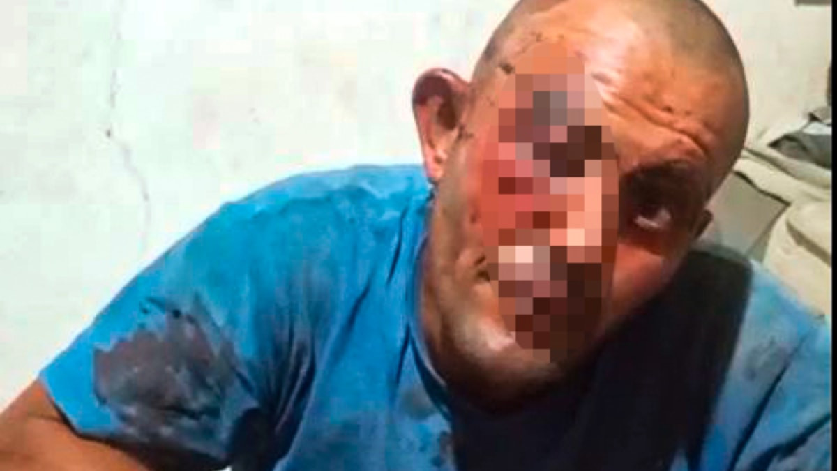 Adana'da zihinsel engelli adam darbedildi